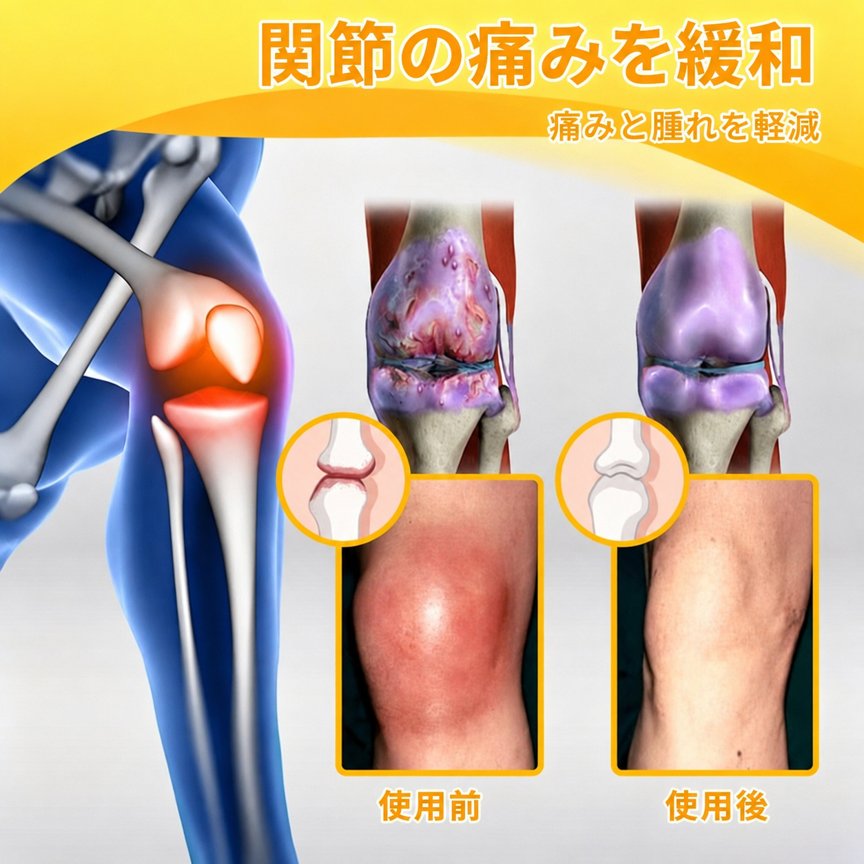 関節の痛みを緩和 日本語版
